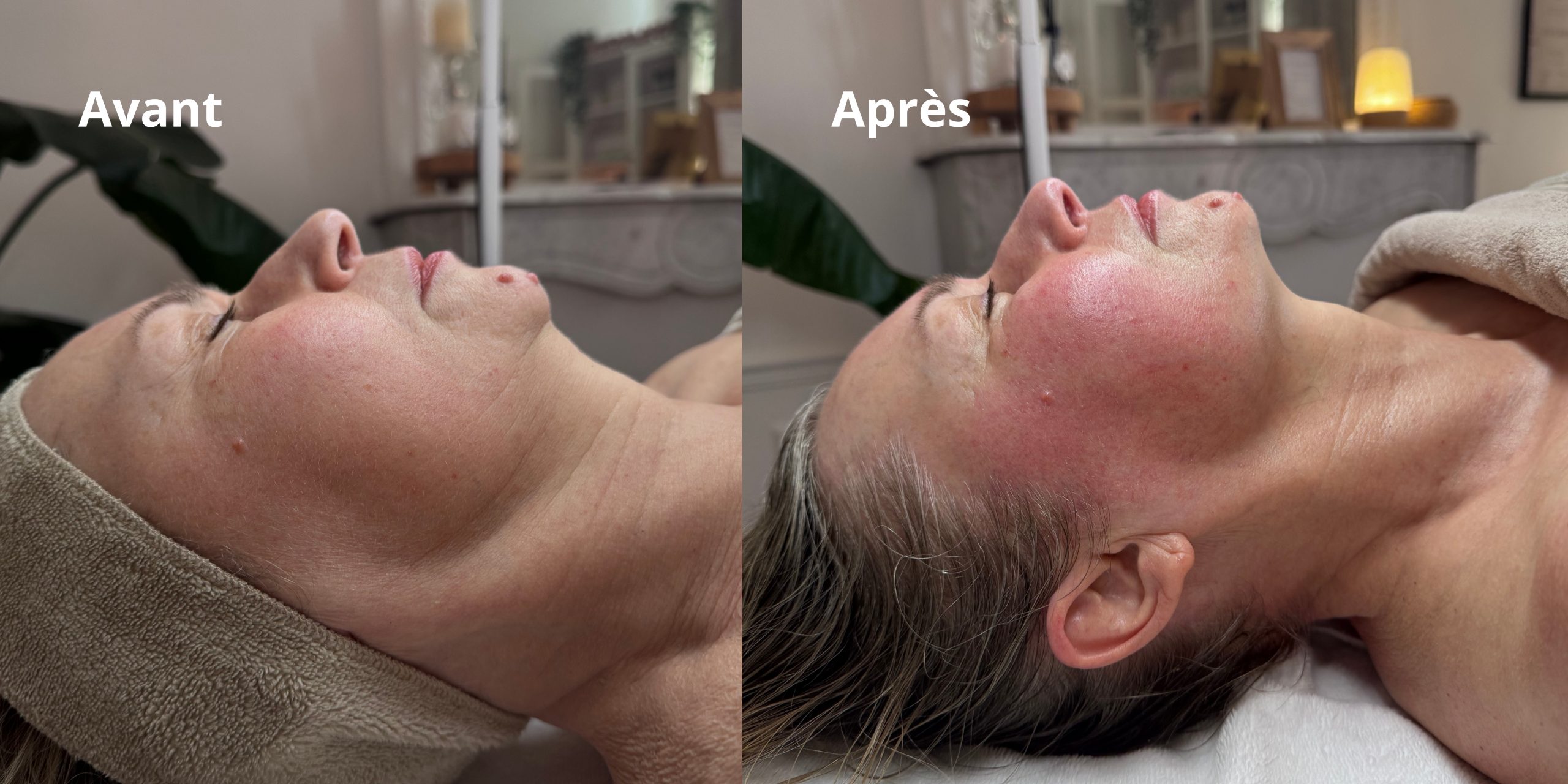 Massage facialiste pour raffermir naturellement l’ovale du visage à Paris 15